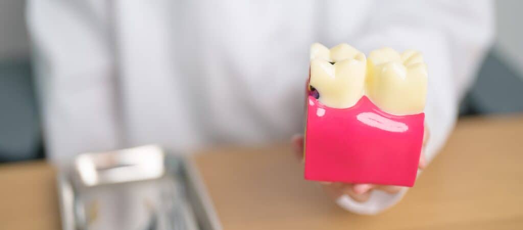 Crack Down on Cracked Tooth Syndrome cracked tooth