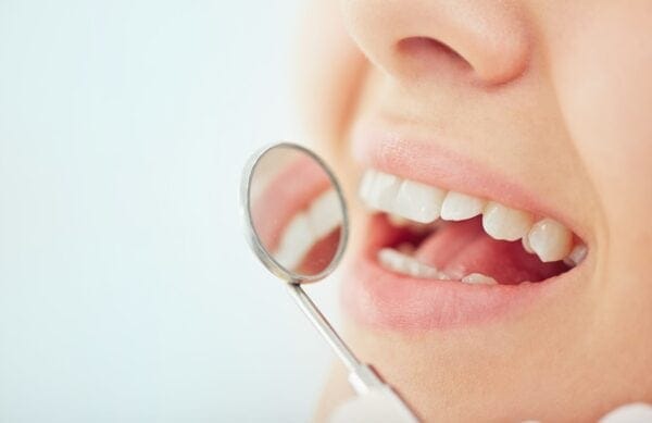 tooth decay