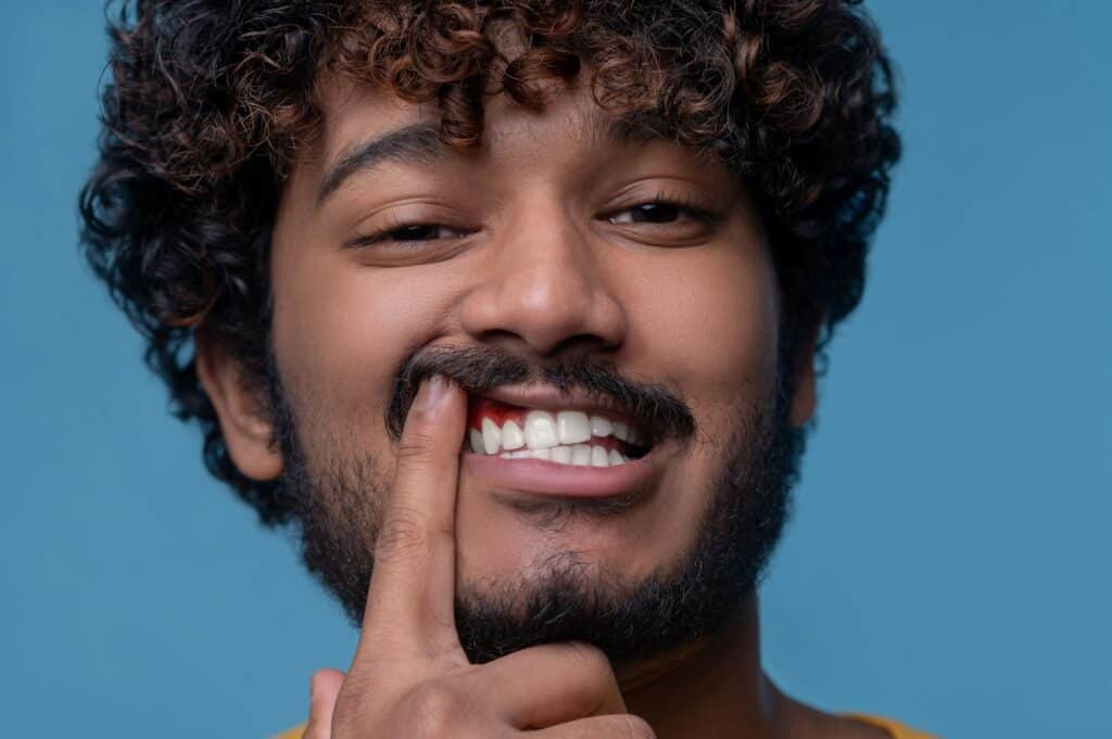 bleeding gums
