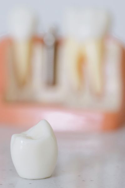 Ignoring a Cracked Tooth cracked tooth